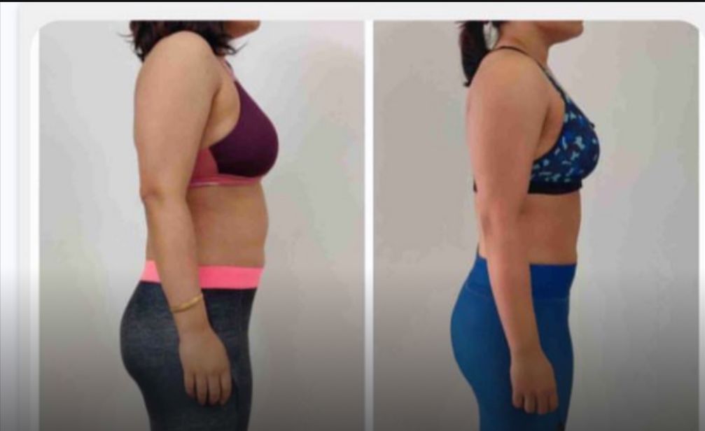 Priya S. before and after transformation